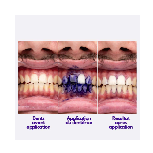 SmileKit V34